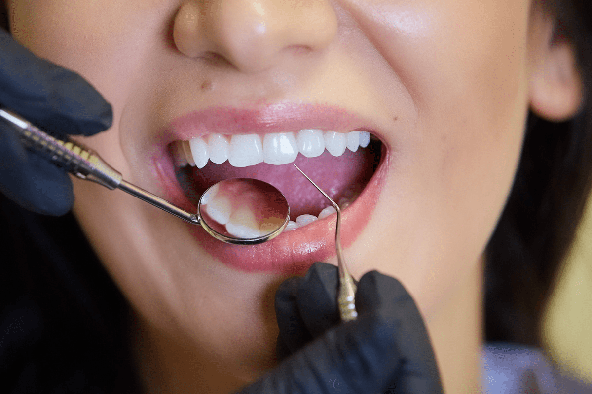 dental check-ups
