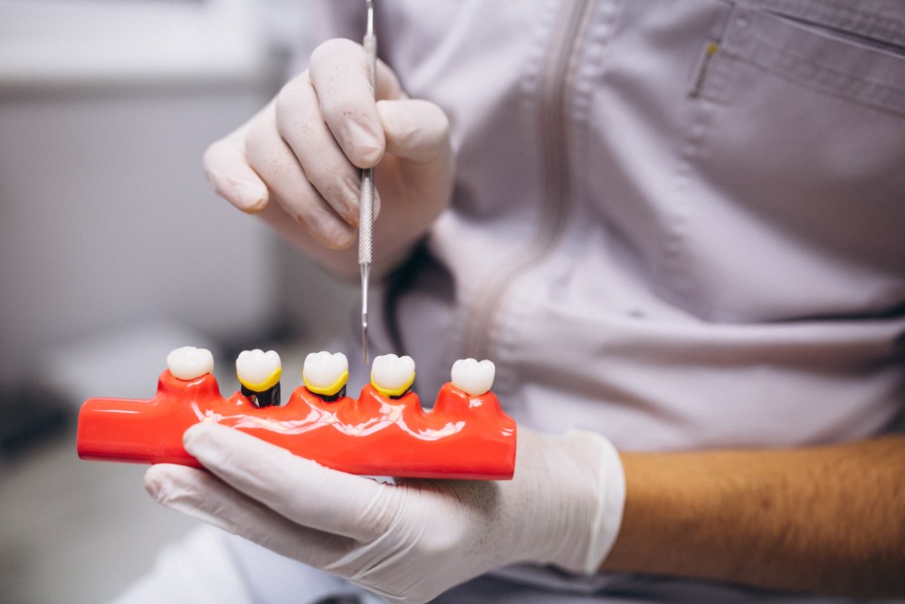 dental_crowns